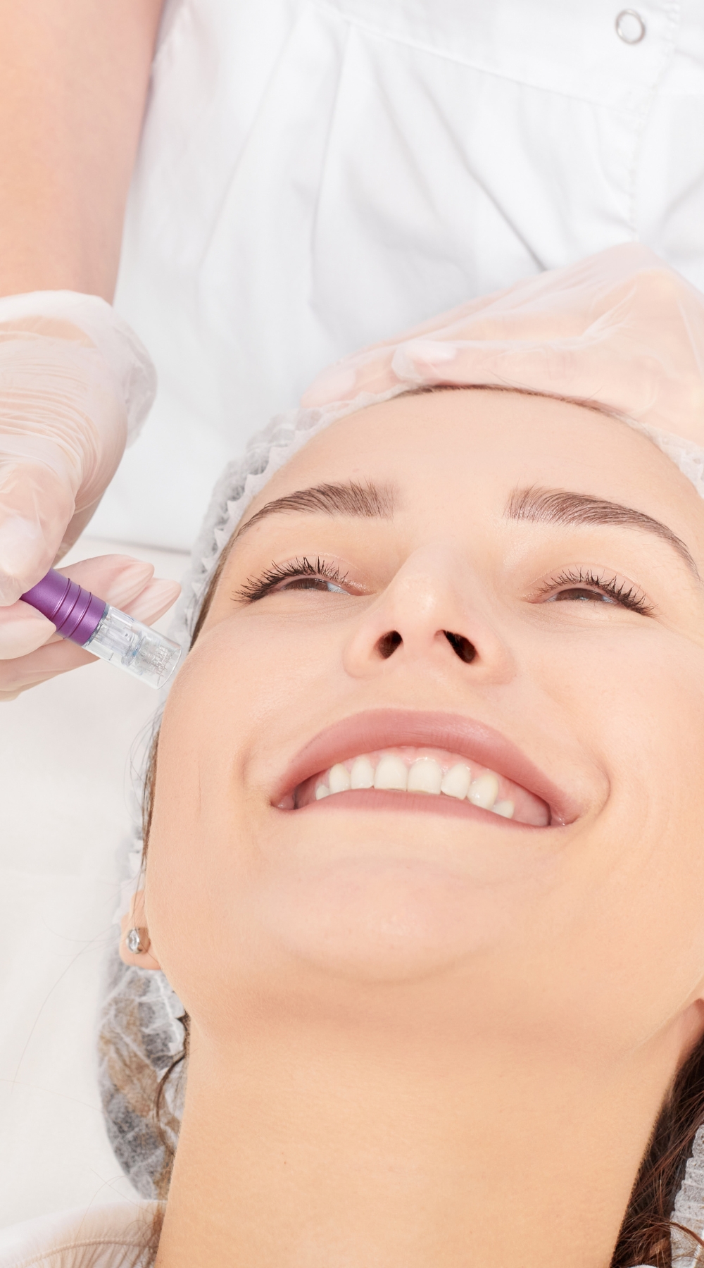 Collagen induction therapy (CIT) Bearwood