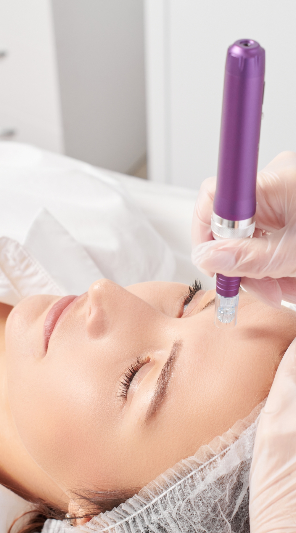 Collagen induction therapy (CIT) Birmingham