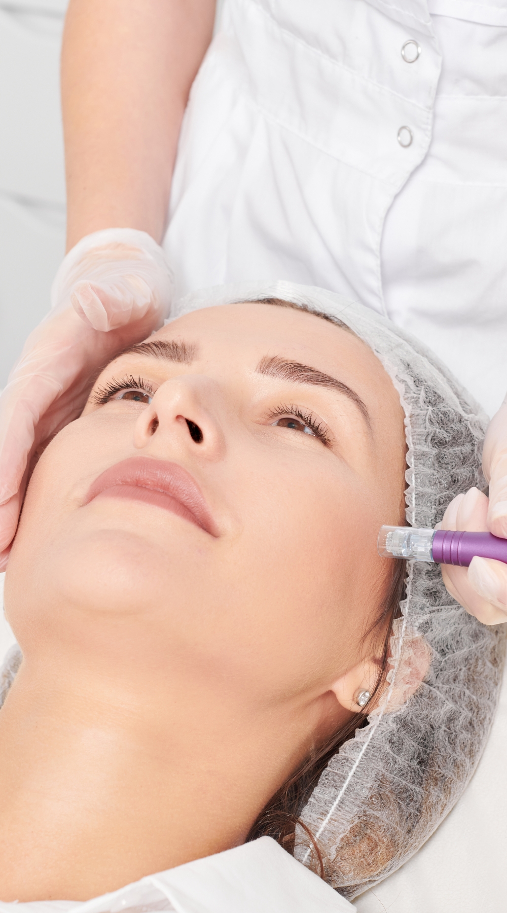 Collagen induction therapy (CIT) Harborne